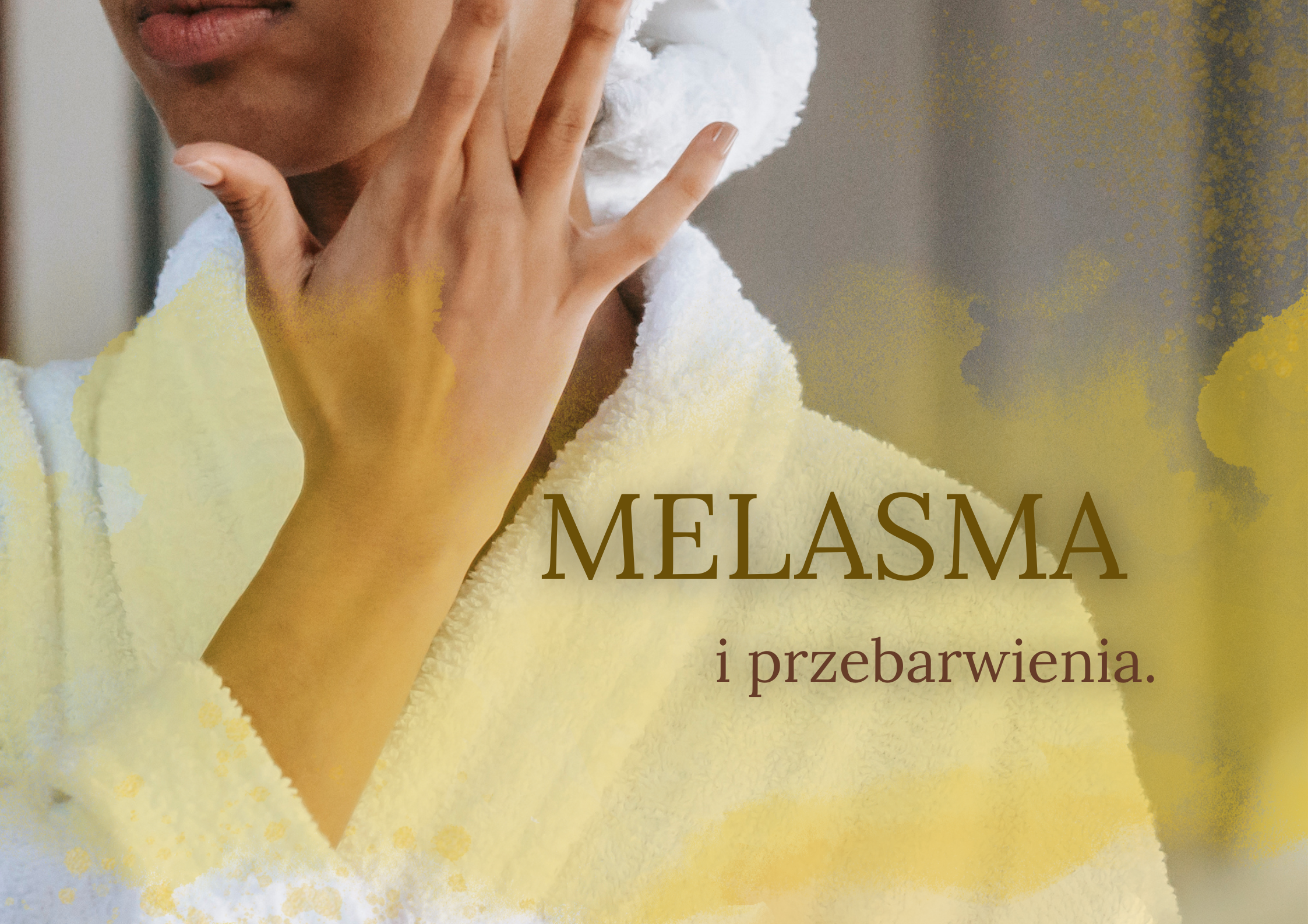 Melasma – Twoja skóra opowiada swoją historię…